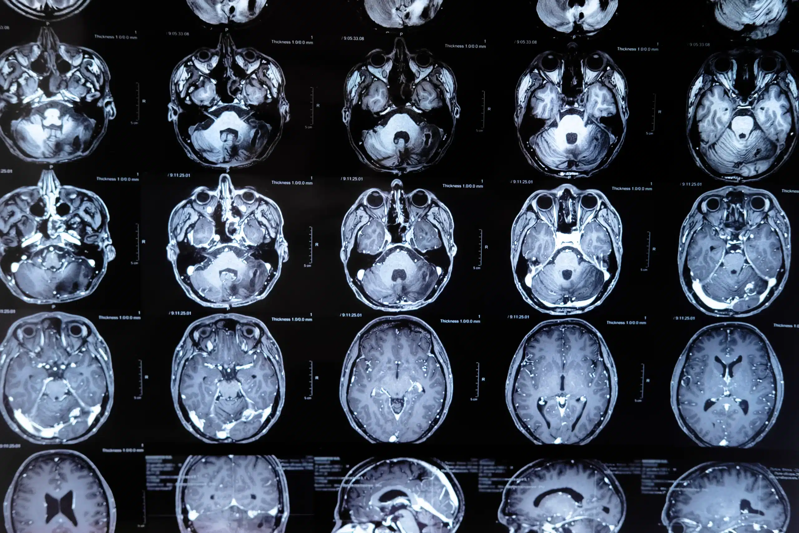 MRI scans of the brain can provide insights into sleep benefits on the body.