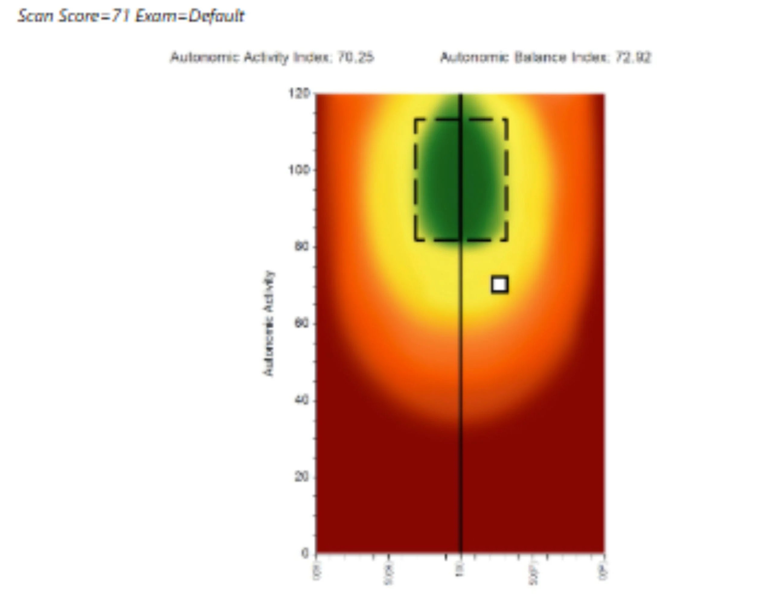 How Supplements Can Improve Heart Rate Variability