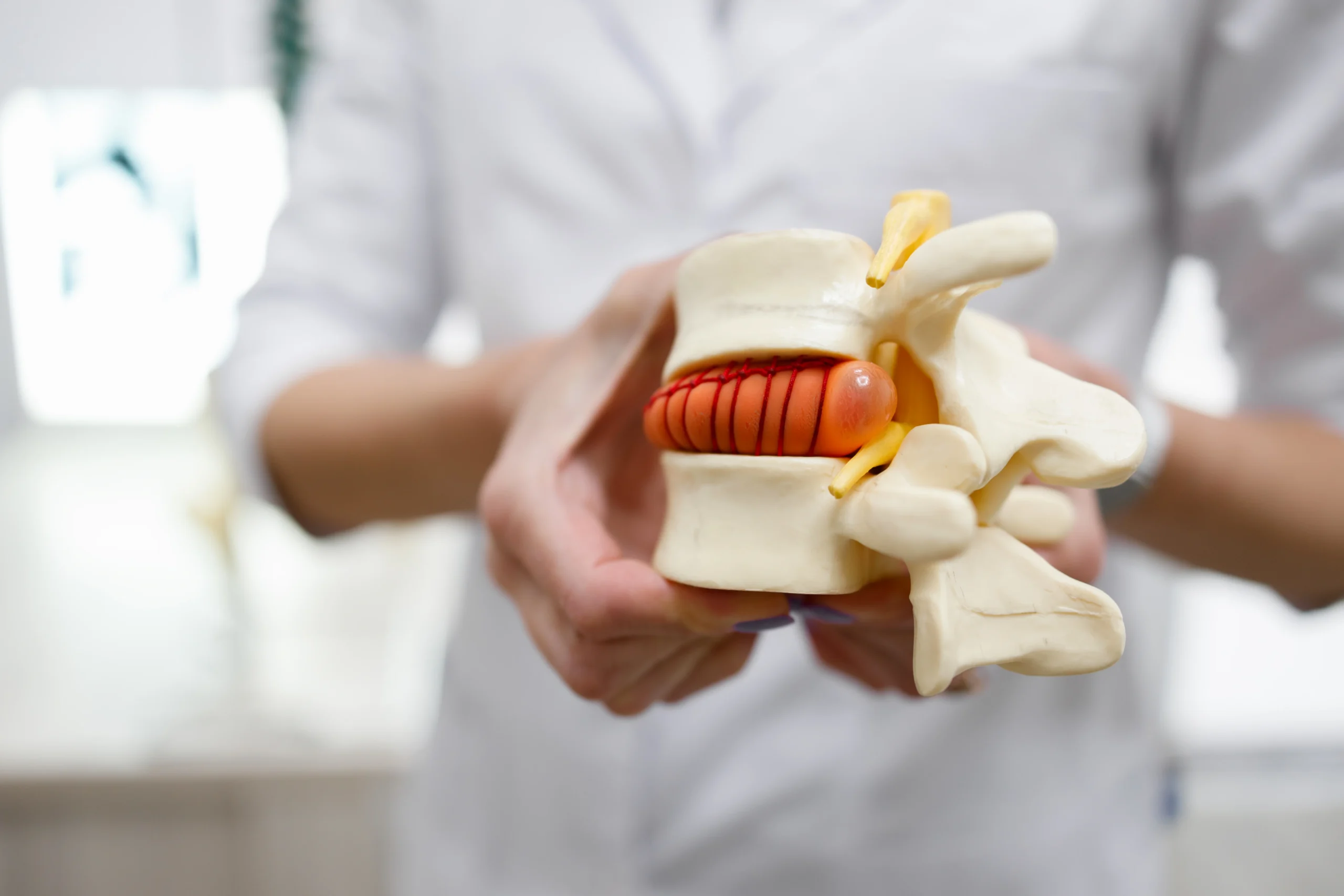 Medical professional holding a anatomical model of lumbar vertebrae, showing an anatomical spinal disc and nerve roots.